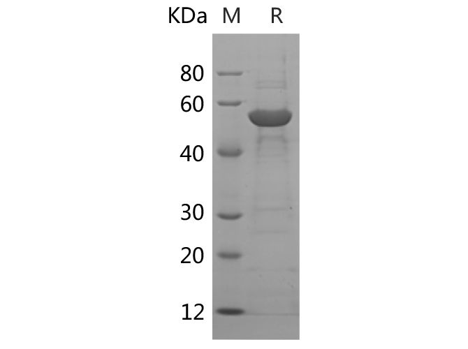 Recombinant Mouse TPO/Thpo Protein(His Tag)-产品推荐-1