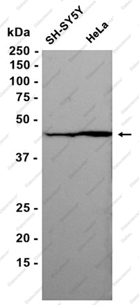 Recombinant NSE Monoclonal Antibody - 2