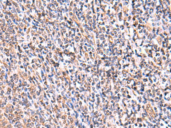 Immunohistochemistry of paraffin-embedded Human tonsil tissue  using UXS1 Polyclonal Antibody at dilution of 1:60(?200)