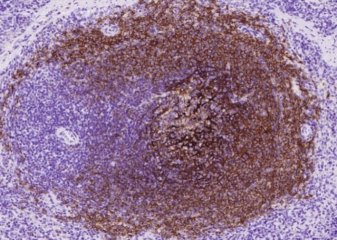 CD21 Monoclonal Antibody - small - 5