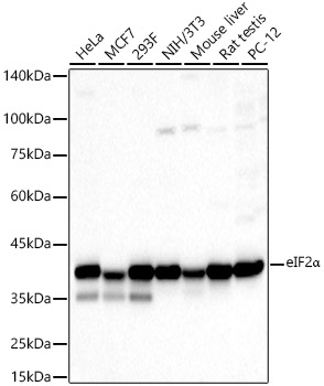 Western blot analysis of various lysates using eIF2α Polyclonal Antibody at 1:500 dilution.