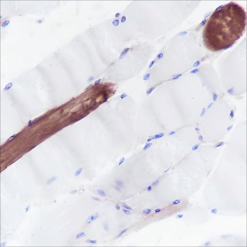 Recombinant Myosin Light Chain 3 Monoclonal Antibody - small - 4