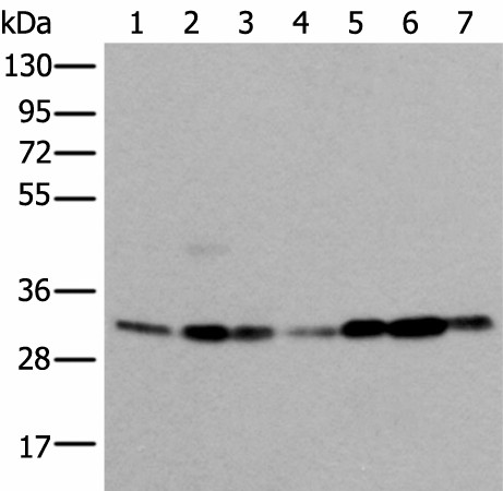 Western blot analysis of 293T Hela Jurkat and A431 cell Human heart tissue Mouse kidney tissue HEPG2 cell lysates  using VDAC1 Polyclonal Antibody at dilution of 1:350