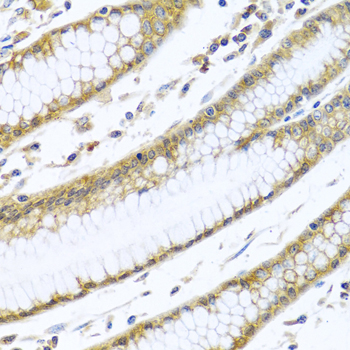 Immunohistochemistry of paraffin-embedded Human stomach using GNAI3 Polyclonal Antibody at dilution of 1:100 (40x lens).
