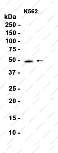 Recombinant Casein Kinase 1 gamma 2 Monoclonal Antibody - 1