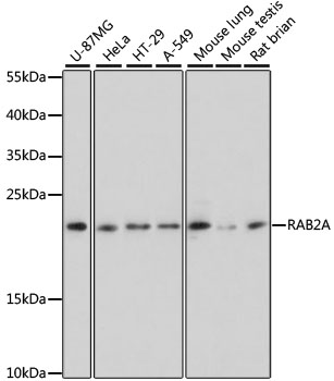 Western blot analysis of extracts of various cell lines using RAB2A Polyclonal Antibody at dilution of 1:3000.