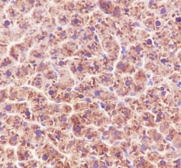 Recombinant ALDH7A1 Monoclonal Antibody - small - 5