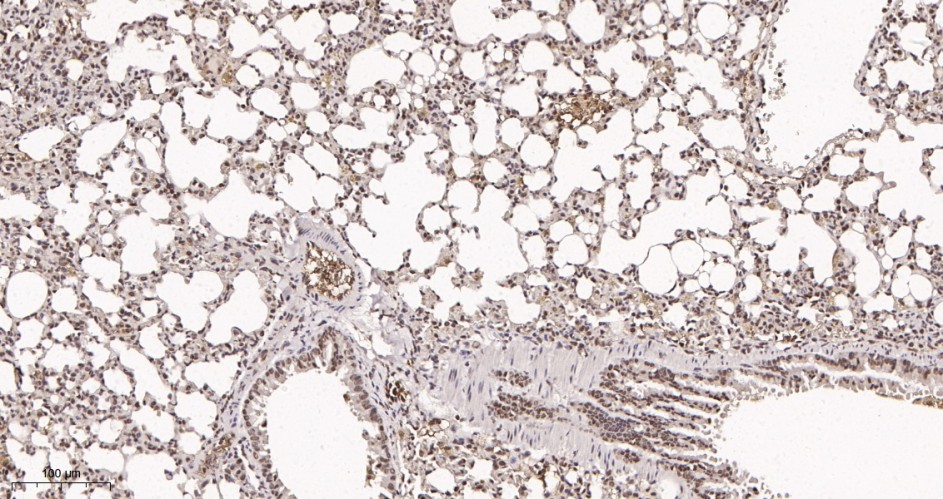 Recombinant ATF-4 Monoclonal Antibody - small - 2