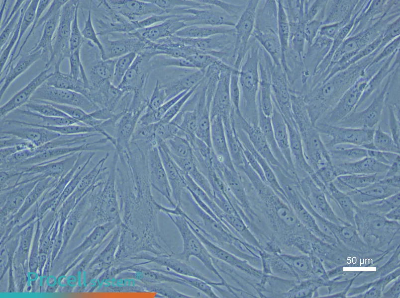 Human Umbilical Vein Smooth Muscle Cell Complete Medium - 6