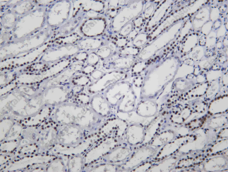 Recombinant OCT1 Monoclonal Antibody - 2