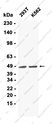 Recombinant NR2F2 Monoclonal Antibody - 2