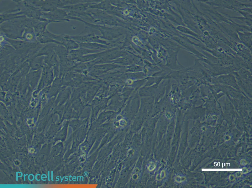 Rat Bladder Fibroblast Complete Medium - 5
