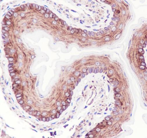 Recombinant IL-1RA Monoclonal Antibody - 3