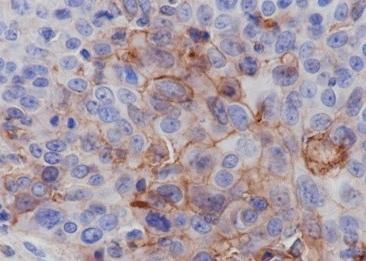 Recombinant PD-L1 Monoclonal Antibody-searchlist-2