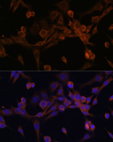 Immunofluorescence analysis of NIH/3T3 cells using EIF2B2 Polyclonal Antibody at dilution of  1:100. Blue: DAPI for nuclear staining.