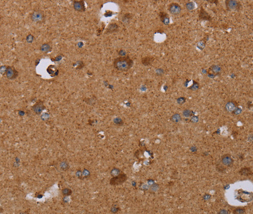 Immunohistochemistry of paraffin-embedded Human brain tissue using DISC1 Polyclonal Antibody at dilution 1:30