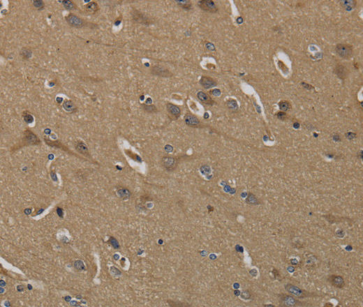 Immunohistochemistry of paraffin-embedded Human brain using KLK6 Polyclonal Antibody at dilution of 1:60