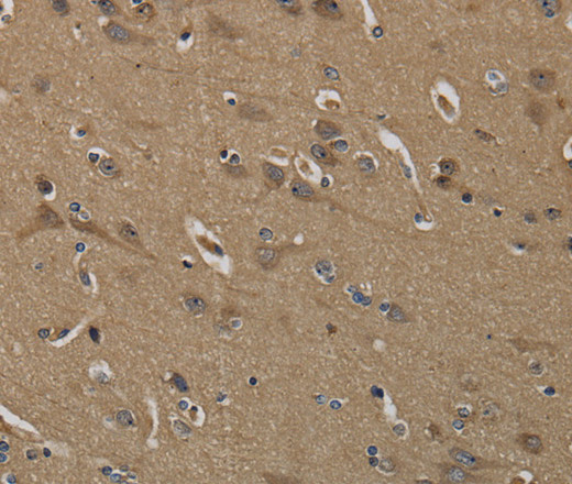 Immunohistochemistry of paraffin-embedded Human brain  using KLK6 Polyclonal Antibody at dilution of 1:60