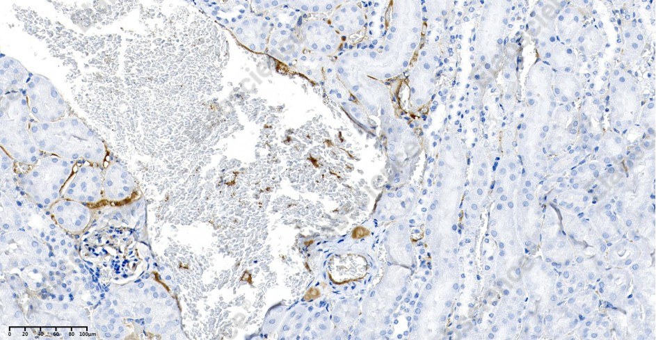 Recombinant LAMP2 Monoclonal Antibody - 3