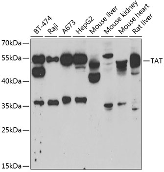 Western blot analysis of extracts of various cell lines using TAT Polyclonal Antibody at 1:1000 dilution.