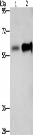 Western blot analysis of Hepg2 cells NIH/3T3 cells  using ZBTB7A  Polyclonal Antibody at dilution of 1:500