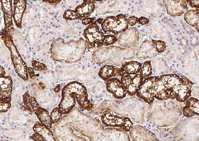KSP-Cadherin/Cadherin-16 Monoclonal Antibody - 1