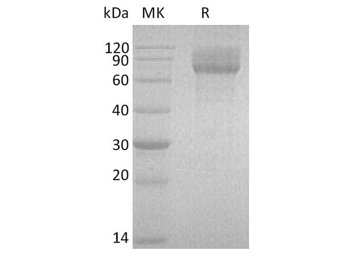 Recombinant Human IL-22BP/IL-22RA2 Protein (Fc Tag)