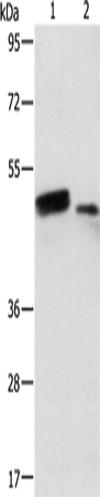 Western Blot analysis of Human liver cancer and normal liver tissue using RARB Polyclonal Antibody at dilution of 1:500