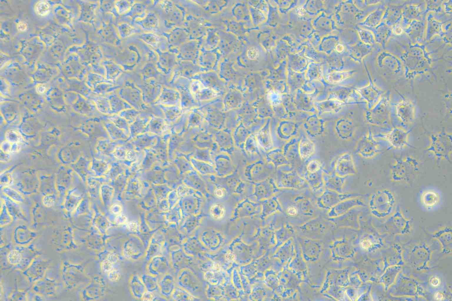 92-1 [Human uveal melanoma] Cell Complete Medium - small - 6