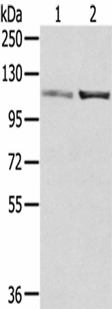 Western Blot analysis of A172 and 231 cells using SENP7 Polyclonal Antibody at dilution of 1/800