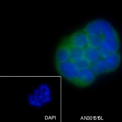 Recombinant EPHB4 Monoclonal Antibody - 2