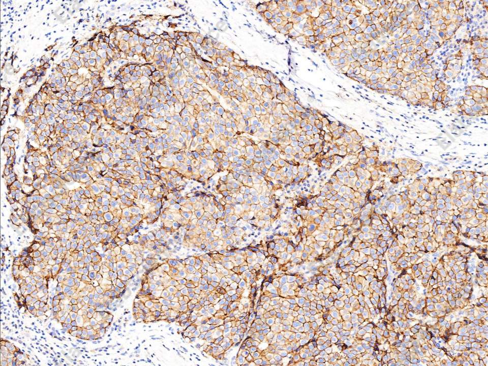Recombinant E-Cadherin/CDH1/E-cad/CD324 Monoclonal Antibody - 1