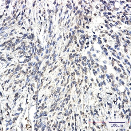 Recombinant Synapsin 2 Monoclonal Antibody - 3