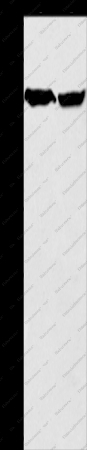 ARHGEF9 Polyclonal Antibody - 1