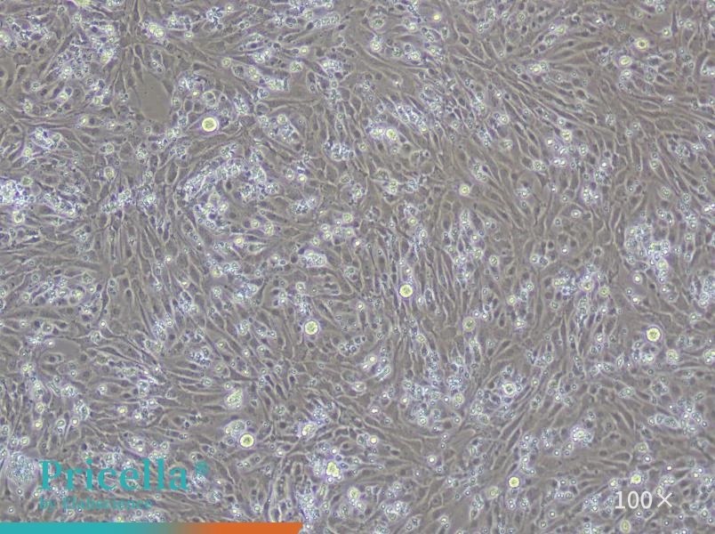 Rat Liver Sinusoidal Endothelial Cell Isolation and Culture Kit - small - 4
