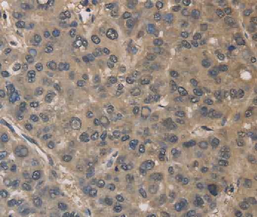 DRG1 Polyclonal Antibody - 3