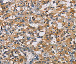 GPM6A Polyclonal Antibody - 3
