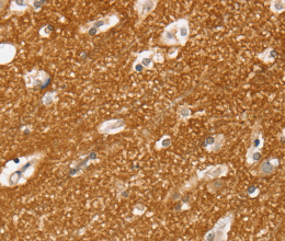 SLC25A13 Polyclonal Antibody - 3