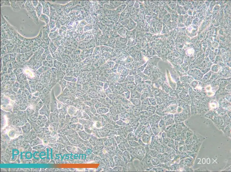 NCI-H2228 [H2228; H-2228] Cell Complete Medium - small - 6