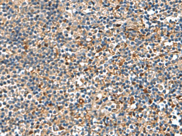 Immunohistochemistry of paraffin-embedded Human tonsil tissue  using TGFBI Polyclonal Antibody at dilution of 1:75(?200)