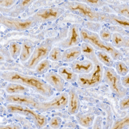 Immunohistochemistry of paraffin-embedded mouse kidney using ACE2 Polyclonal Antibody at dilution of 1:50 (40x lens).Perform high pressure antigen retrieval with 10 mM citrate buffer pH 6.0 before commencing with IHC staining protocol.