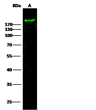 MKI67 Monoclonal Antibody - small - 2
