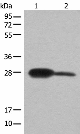 Western blot analysis of Mouse kidney tissue and A172 cell lysates  using BDH2 Polyclonal Antibody at dilution of 1:600