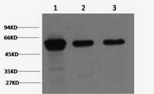 Western Blot analysis of 1) Hela, 2) Mouse brain, 3) Rat brain using Vimentin Monoclonal Antibody at dilution of 1:2000.