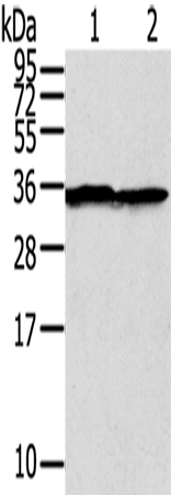 Western Blot analysis of A375 cell using STX3 Polyclonal Antibody at dilution of 1:400