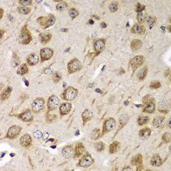 Immunohistochemistry of paraffin-embedded Mouse brain using TMED10 Polyclonal Antibody at dilution of 1:100 (40x lens).