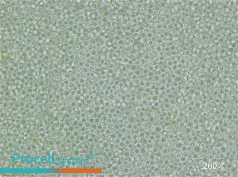 SU-DHL-4 Cell Complete Medium - 6