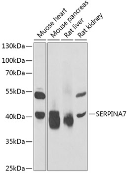 Western blot analysis of extracts of various cell lines using SERPINA7 Polyclonal Antibody at 1:1000 dilution.