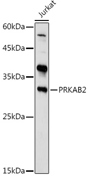 Western blot analysis of extracts of Jurkat cells using PRKAB2 Polyclonal Antibody at cells using PRKAB2 Polyclonal Antibody at 1:1000 dilution.