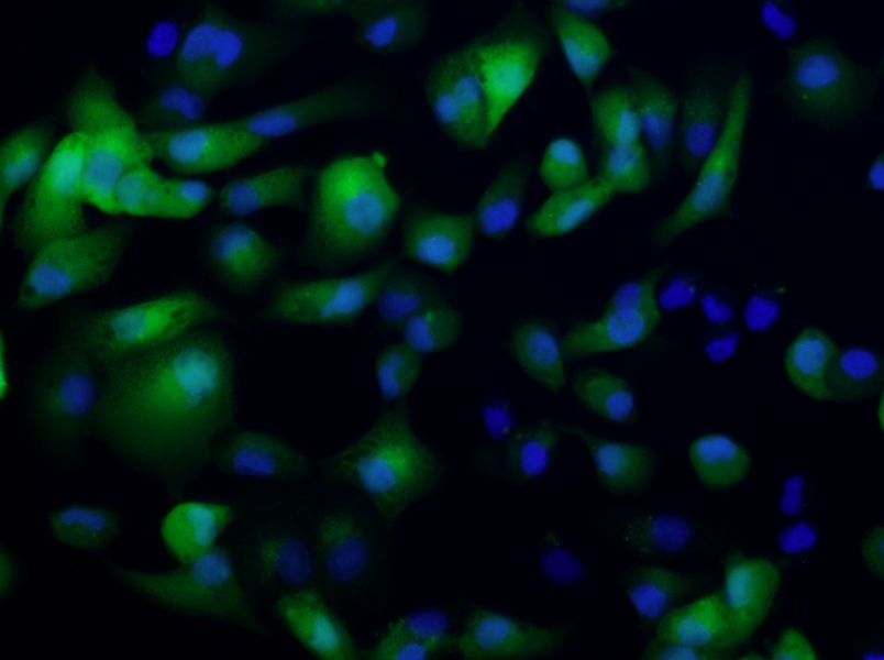 ACHN-GFP Cell Complete Medium - 5